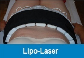 Lipo Laser